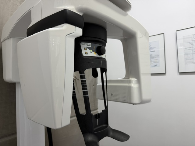 3D dental CT scanner used at Smile Tijuana