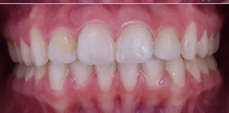 After — Case 5