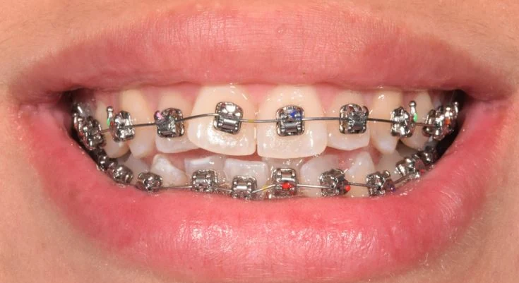 After — Case 12