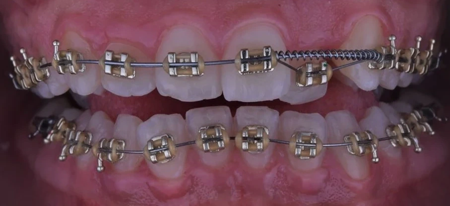 After — Case 4