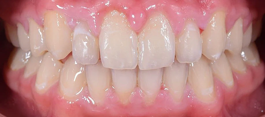 After — Case 6