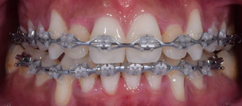 After — Case 5