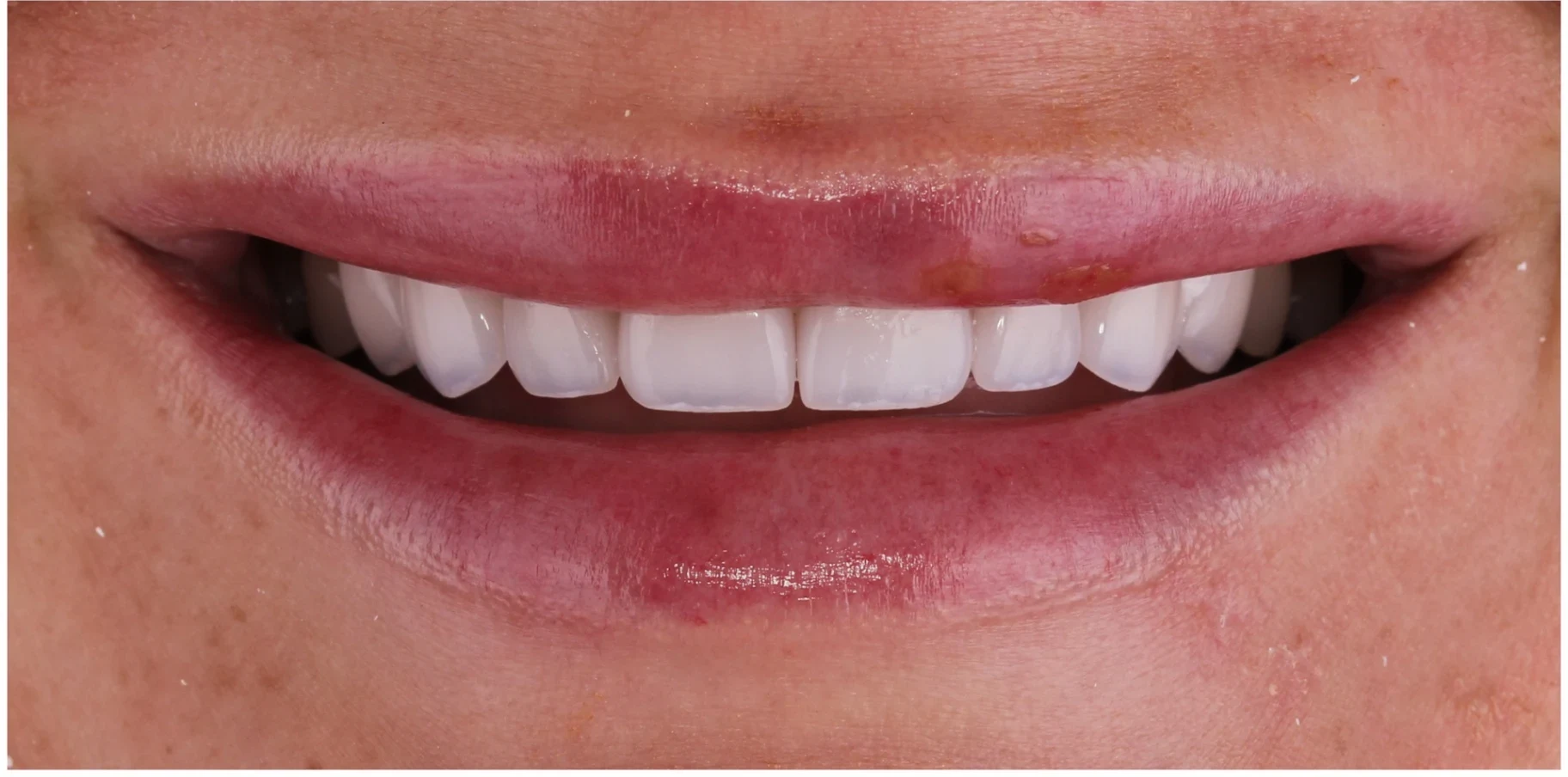 After — Case 4