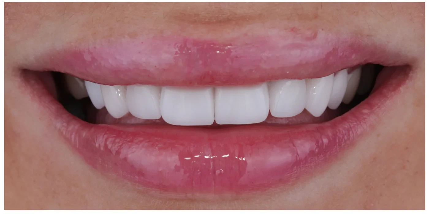 After — Case 1