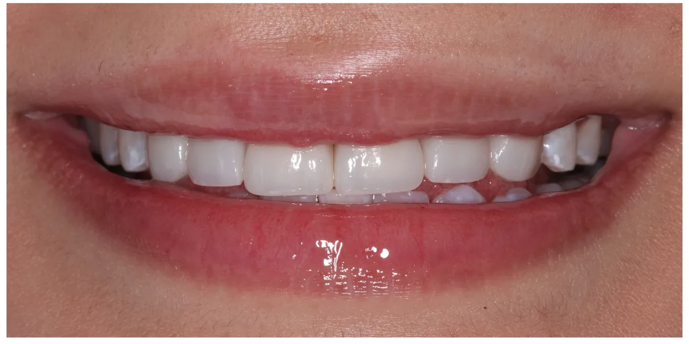 After — Case 2