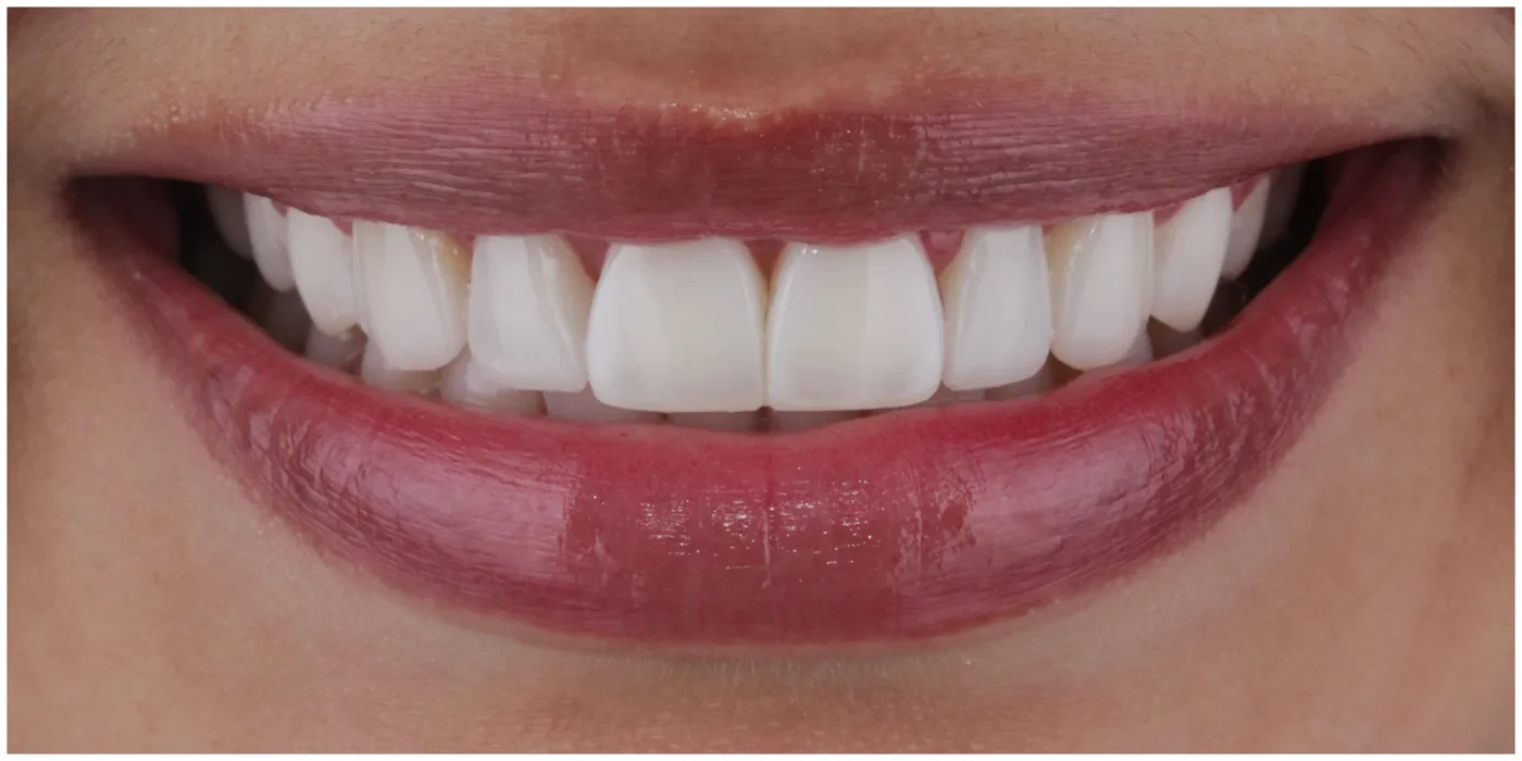 After — Case 4